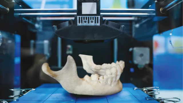 Ahora vas a poder tocar tu radiografía (con impresoras 3D) 