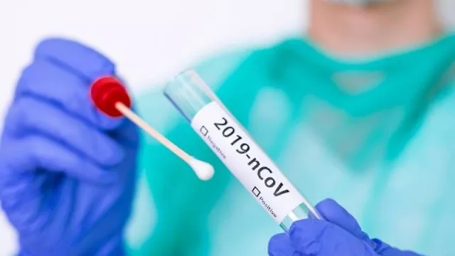 Para muchas cosas va a hacer falta tener un PCR negativo (dónde se hacen y cómo se pagan)