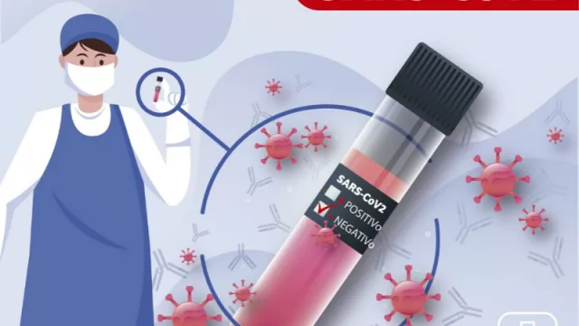 Por $ 1.200 ya podés saber si tenés anticuerpos de COVID-19 (en el laboratorio de Reina Fabiola)