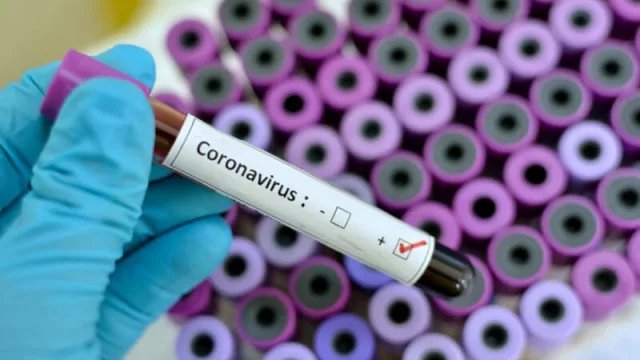 Vos y el coronavirus: ¿Cómo estás? ¿Qué opinás?