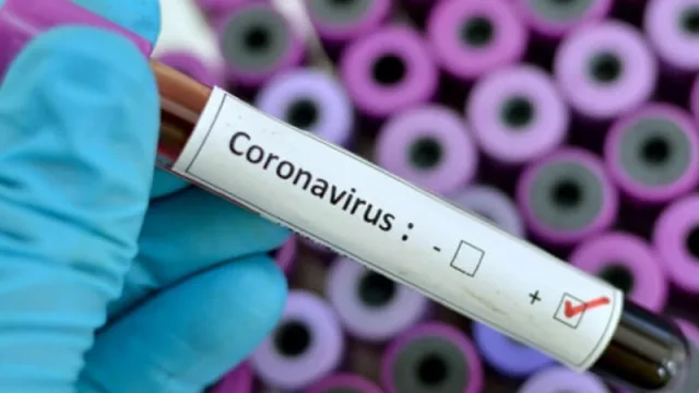 ¡Liberan los datos! ¿Por qué el Malbrán no informa la cantidad diaria de muestras que analiza?