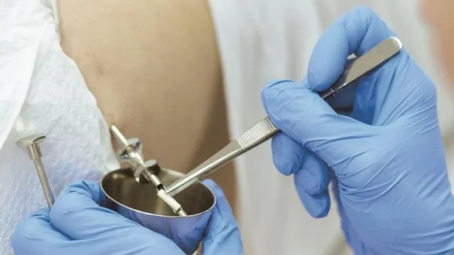 Sobre el “chip sexual”, aporta...