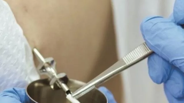 Ya se coloca en Córdoba el “chip sexual” con testosterona bioidéntica (hombres $ 30.000; mujeres $ 18.000)