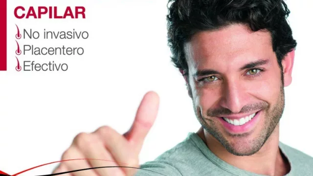 La franquicia del día: Instituto Sehar de Recuperación Capilar (desde los $160.000)