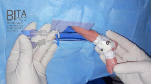 Tecnología médica con sello cordobés: Silmag capacitó a profesionales de 13 países (para el uso de sus dispositivos BITA PICC)