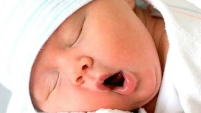 Resultados de encuesta anterior