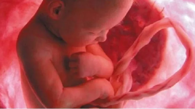 Nacen más chicos por cesárea… ¿por qué?