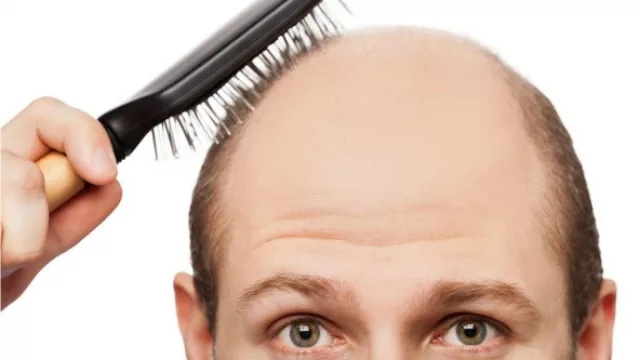 Medical Hair llega Paraguay para solucionar los problemas “desde la raíz”