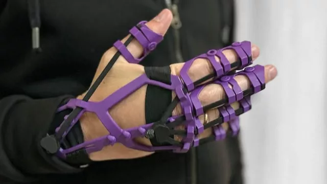 TecnoMotion: la startup cordobesa que desarrolla exoesqueletos y prótesis hasta 80% más económicos que los importados