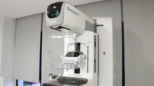 La Clínica Reina Fabiola incorpora el primer mamógrafo 3D con inteligencia artificial de Córdoba