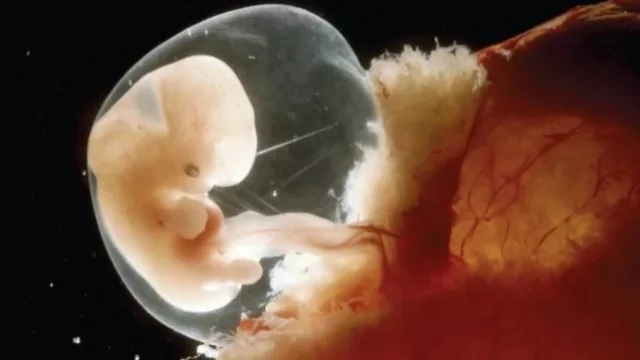 La donación de placenta marca un récord en Córdoba y revoluciona el tratamiento de quemaduras y lesiones