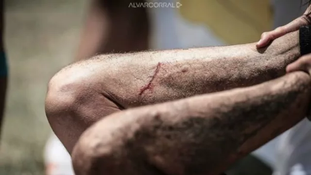 Correr a pesar de todo...