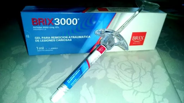 Invento local pone fin al trauma de ir al dentista (gel que elimina caries sin torno ni anestesia)