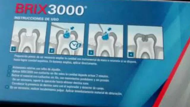 BRIX 3000 permite eliminar las caries sin dolor y sin usar anestesia.