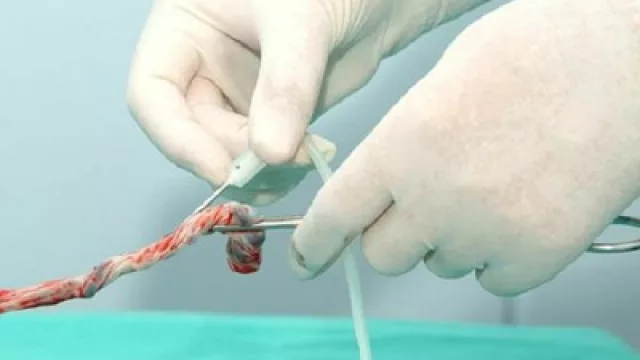 Considera que las células madres privadas deben ser públicas (la Corte ya falló)