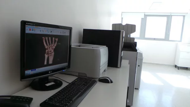 Alrededor de 200 “radiografías digitales” se realizan en el Allende del Cerro. En Nueva Córdoba, se hacen unas 600.