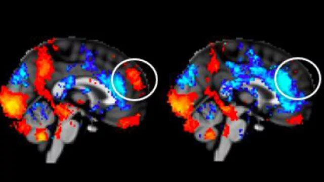 Neurensics Latin America llegó a la Argentina para hacer resonancia magnética a los consumidores