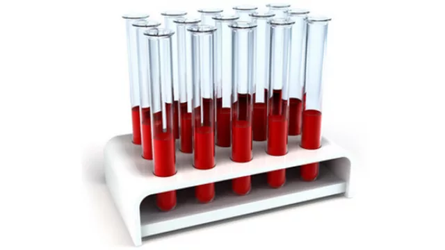 Hemoderivados suma 3.600 m2 y anuncia nuevas inversiones para seguir creciendo