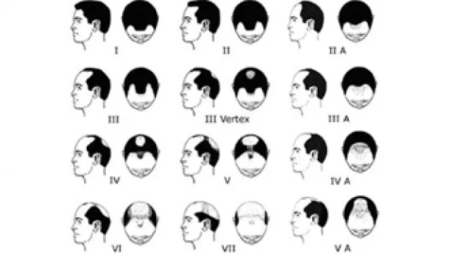 El test genético ADN Hair ya se vende en Córdoba (prevén facturar más de $ 7 millones en tres años)