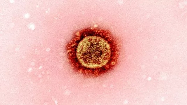 ¿Salió el SARS-CoV-2 de un laboratorio?